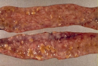 Koktsidioosi poolt kahjustatud küüliku sooled, foto Richard Hoop