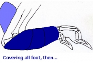 Pododermatiit sidumine