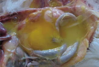 Rebuperitoniit, foto: https://www.ncbi.nlm.nih.gov/pmc/articles/PMC3805102/