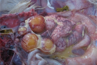 Rebuperitoniit, foto: https://www.ncbi.nlm.nih.gov/pmc/articles/PMC3805102/