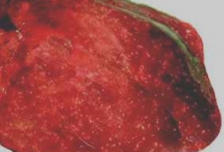 Tyzzer, foto Israel Journal of Veterinary Medicine